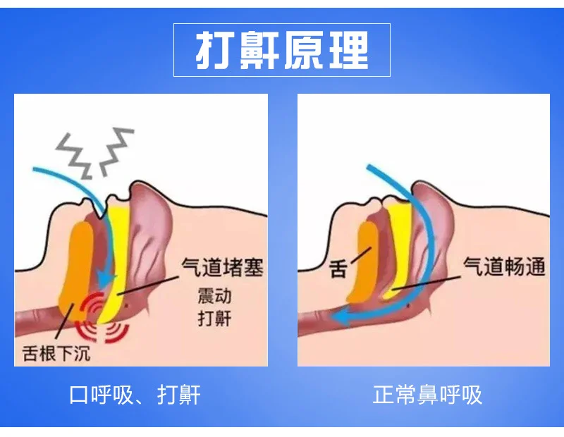 鼾立停喷剂植物舒缓鼻腔打呼噜止鼾打鼾鼻鼾成人呼噜消液代发 鼾立停喷剂植物舒缓鼻腔打呼噜止鼾打鼾鼻鼾成人呼噜消液代发
